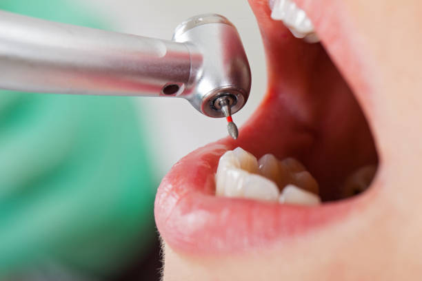 Best Pediatric Emergency Dentist in Newberry, MI